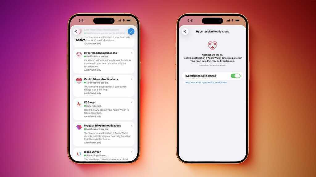 Người dùng Apple Watch đã có thể sử dụng tính năng cảnh báo huyết áp