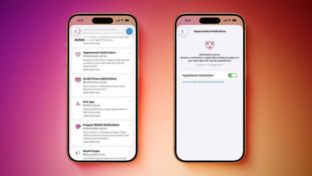 Người dùng Apple Watch đã có thể sử dụng tính năng cảnh báo huyết áp - 1