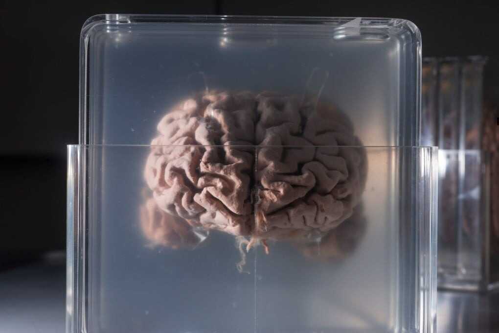 Công nghệ lập bản đồ RNA mới mở ra cơ hội giải mã bộ não Einstein và kho báu di truyền bị lãng quên