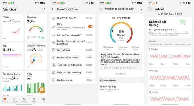 Trên tay Huawei WATCH FIT 5 và 5 Pro: Màn hình sáng tới 3.000 nit, bản Pro có ECG, đánh giá nguy cơ tiểu đường  - Ảnh 16.