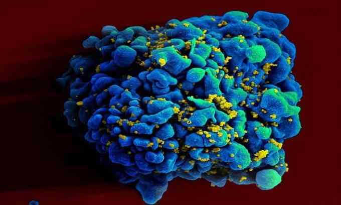 Vaccine mARN ngăn HIV cho kết quả tốt ở động vật