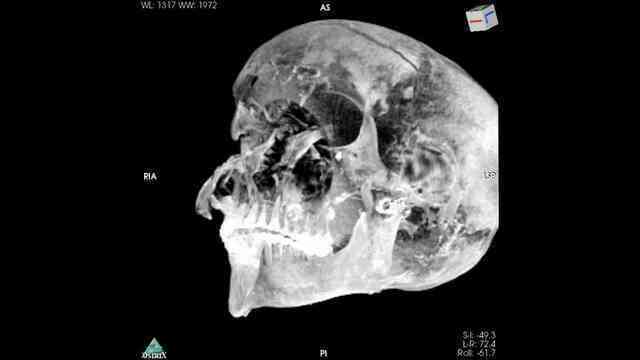 Xác ướp hé lộ pharaoh Ai Cập bị xử tử ngay trên chiến trường