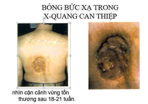 TS Đặng Thanh Lương: 