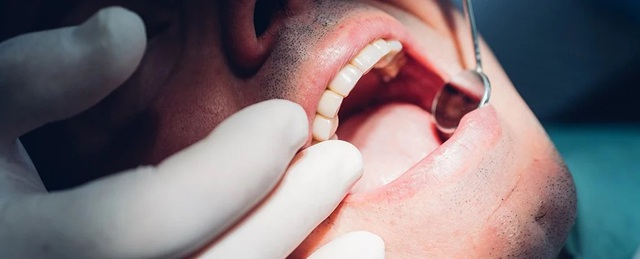 Vì sao răng ê buốt khi ăn uống đồ lạnh?