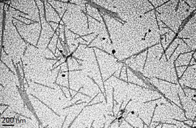 Virus đầu tiên được giới khoa học phát hiện là gì?