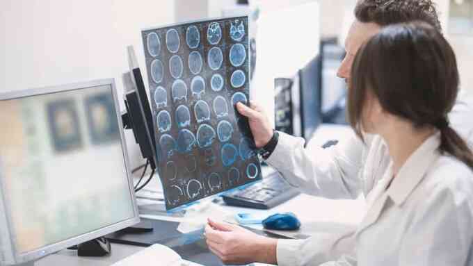 Não người xử lý thông tin chậm hơn các giác quan