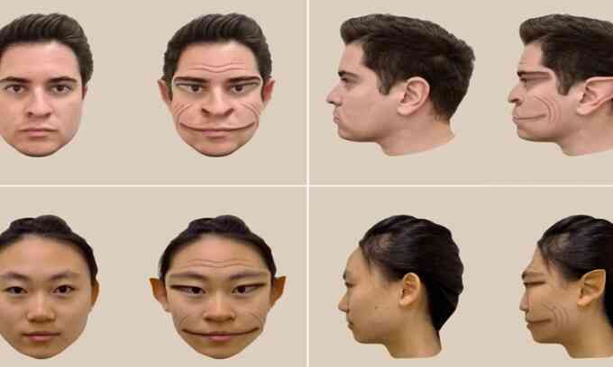 Hội chứng cực hiếm khiến con người trông thấy 