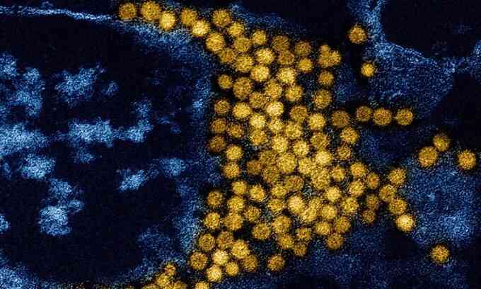 AI tìm kiếm hàng nghìn tỷ virus trong cơ thể người