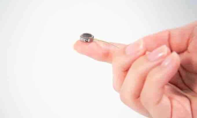 Công ty đối thủ của Neuralink cấy chip não ở người