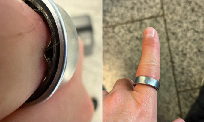 Nhẫn Galaxy Ring kẹt ở ngón tay do phồng pin