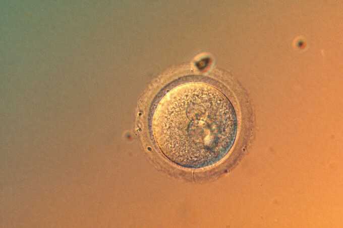Lần đầu chỉnh sửa chính xác gene phôi người