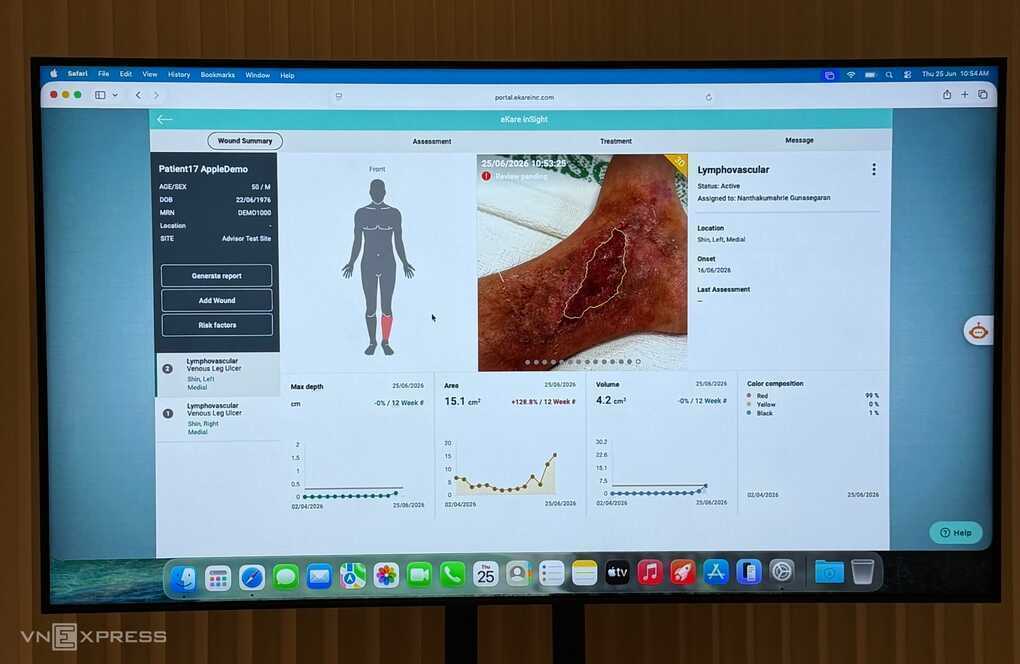 AI trên iPhone, iPad hỗ trợ khám chữa bệnh ở Singapore